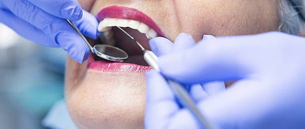 Best Broken or Cracked Tooth Emergency Dentist in Springville, AL